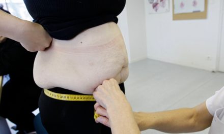 What Is Bariatric Or Weight Loss Surgery?