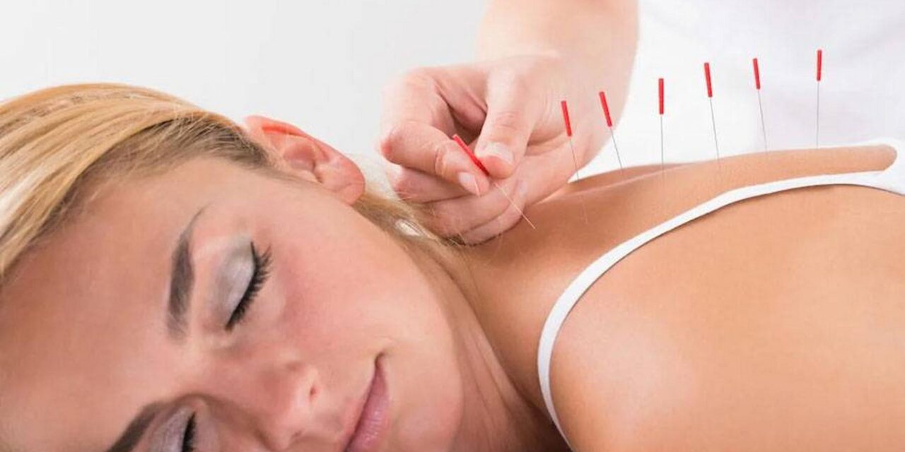 Why One Should Go With Dry Needling Therapy?