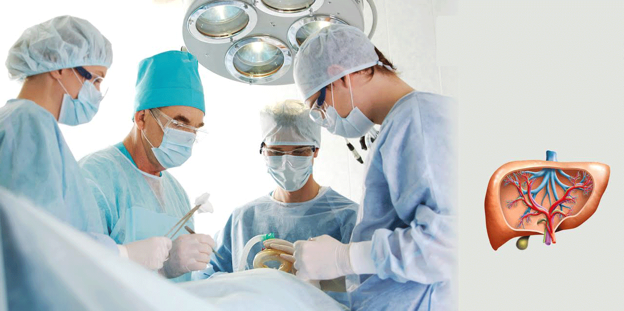 Liver Transplantation: The Toughest And Important Surgical Procedure For Liver Failure